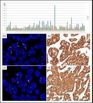 數(shù)字PCR：客觀、快速且準(zhǔn)確檢測(cè)肺癌ALK狀態(tài) —— 曾瑄教授團(tuán)隊(duì)新進(jìn)展！